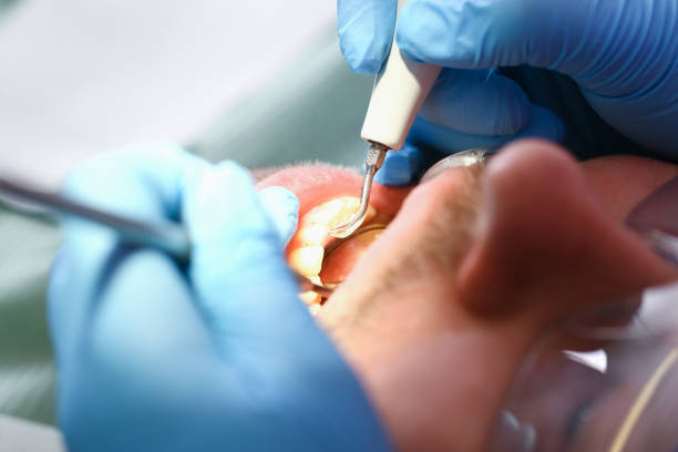 Best Emergency Denture Repair in Lake View, AL